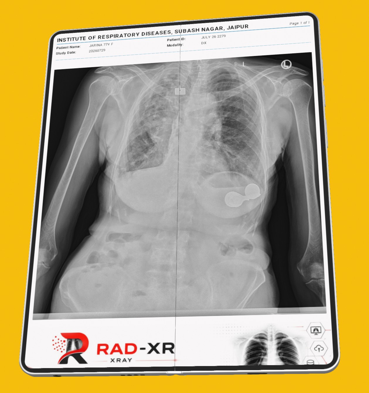 RAD-XR processed medical image and DICOM imaging workflow